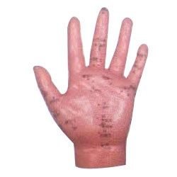 Hand Acupuncture Model