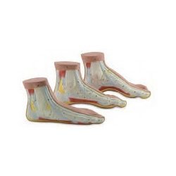 Normal And Abnormal Feet